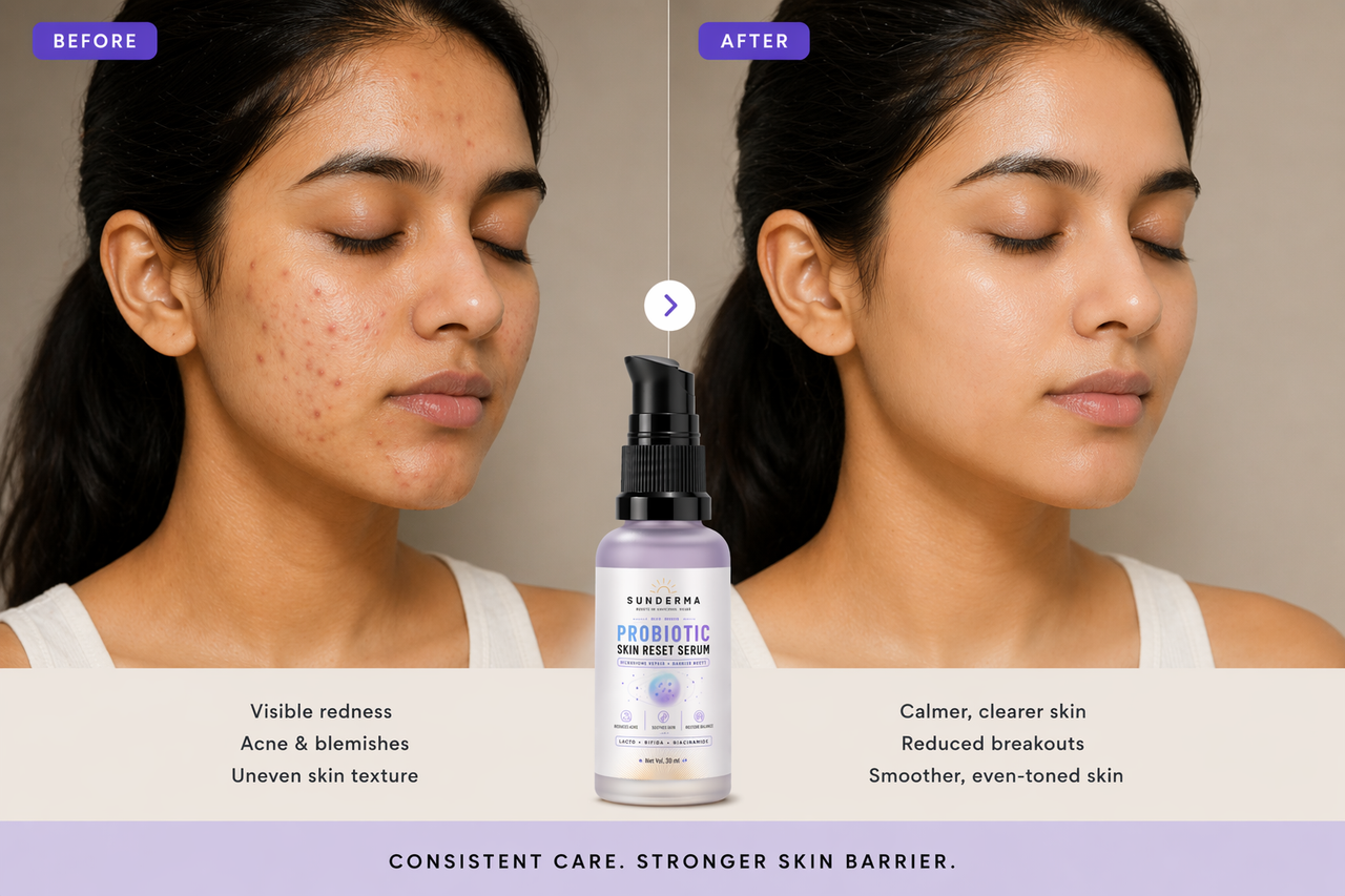 Sunderma Probiotic Skin Reset Serum – Microbiome Repair + Barrier Boost