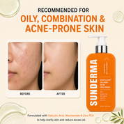 SUNDERMA DustClear Oil-Free Acne Clear Face Wash with Salicylic Acid, Niacinamide & Zinc PCA for Oily, Combination & Acne-Prone Skin | 125 ml